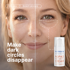 Matriskin NoPad Peri-Orbital Eye Cream for periorbital puffiness, periorbital puffiness causes, edema under eyes, under-eye edema, fluid retention under eyes, fluid around eyes, microcirculation under eyes, puffiness, eye bags and dark circles.