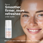 Matriskin NoPad Peri-Orbital Eye Cream for periorbital puffiness, periorbital puffiness causes, edema under eyes, under-eye edema, fluid retention under eyes, fluid around eyes, microcirculation under eyes, puffiness, eye bags and dark circles.